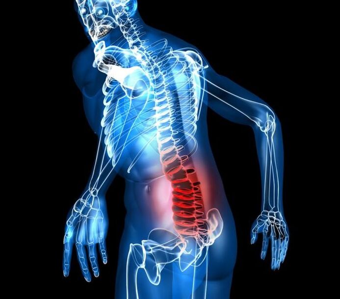 Degree and development phases of lumbar osteochondrosis