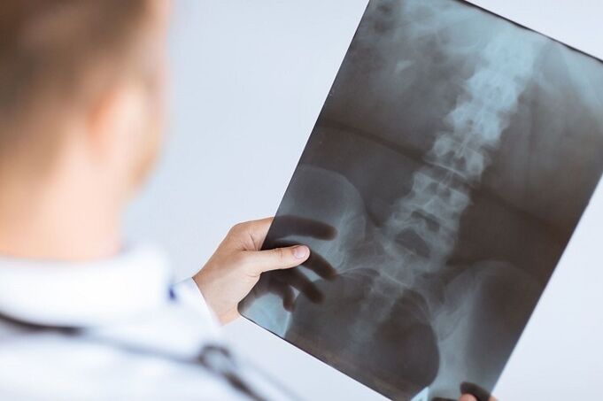 Diagnosis options for lumbar osteochondrosis